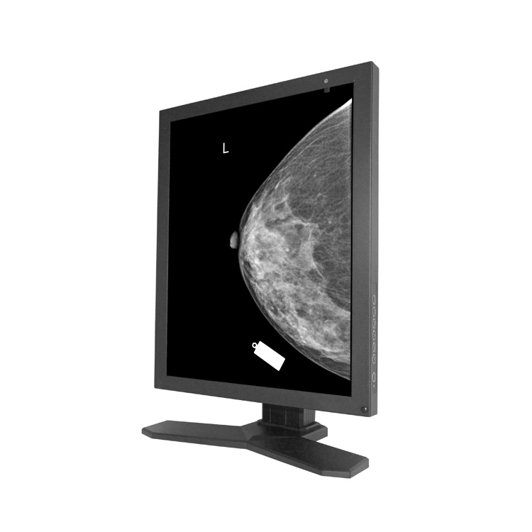 MSLMD10 5MP hospital medical mammography screen viewer/ radiology ...