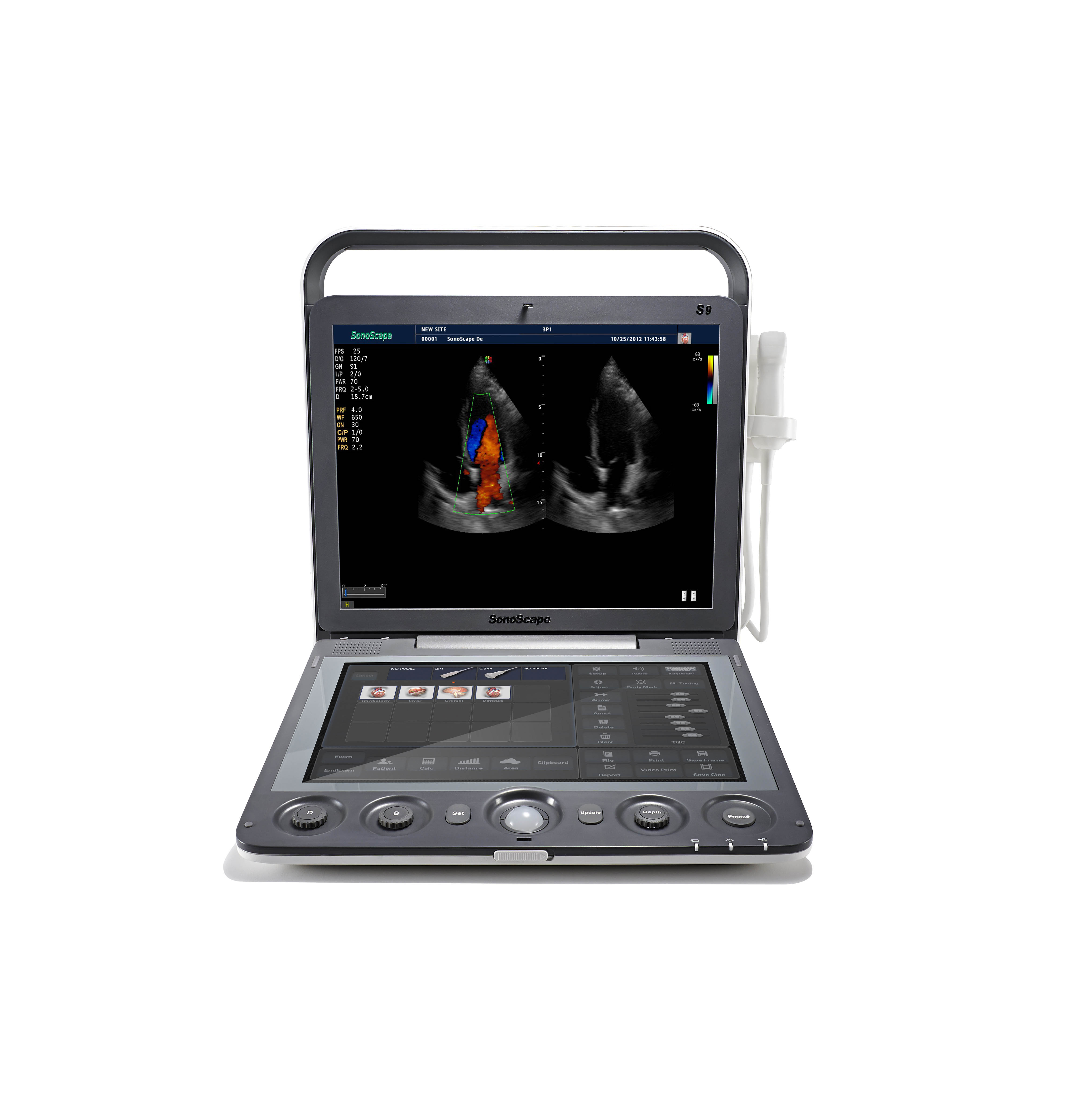 Ultrasound Portable Color Doppler System High Density Probe High Quality For Vet